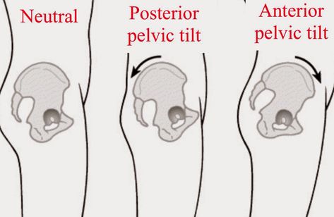 pelvic tilt lower crossed Tight Pelvic Floor, Psoas Release, Pelvic Girdle, Pelvic Floor Dysfunction, Tight Hamstrings, Pelvic Tilt, Tight Hip Flexors, Psoas Muscle, Sciatic Nerve Pain