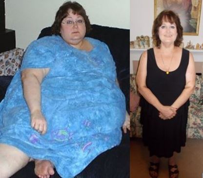 Read weight loss stories from all diet plans @ www.TheWeighWeWere.com See more at http://theweighwewere.com/losing-over-200-pounds-and-getting-my-freedom-back/ Gastric Balloon, Weight Problems, Transformation Body, Lose Belly, Healthy Weight, Lose Belly Fat, Fat Loss, Surgery, Fitness Motivation