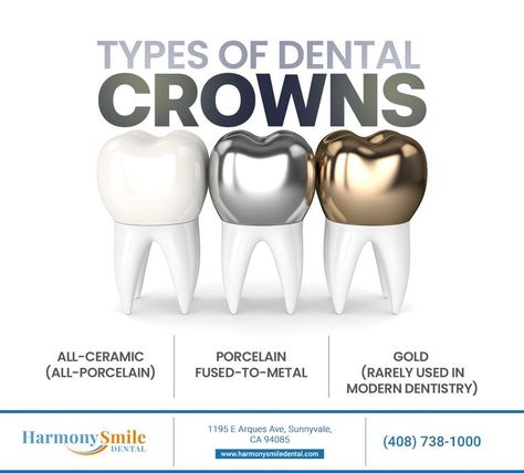 Dental crowns help preserve severely damaged or decayed teeth. The material selected is determined on your unique needs. Visit our website at http://HarmonySmileDental.com to learn more about crowns. #dentalcrown #harmonysmiledental #sunnyvale #CA Holistic Dentistry, Family Dental Care, Family Dentist, Dental Center, Dental Art, Dental Crowns, Family Dental, General Dentistry, Family Dentistry