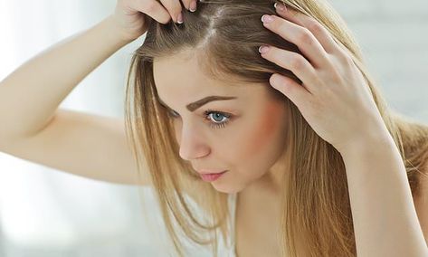 What does YOUR dandruff say about your health? Hair Myth, Prp Hair, Dunner Wordend Haar, Hair Growth Cycle, Pattern Baldness, Hair Replacement, Oily Hair, Dry Scalp, Hair Regrowth