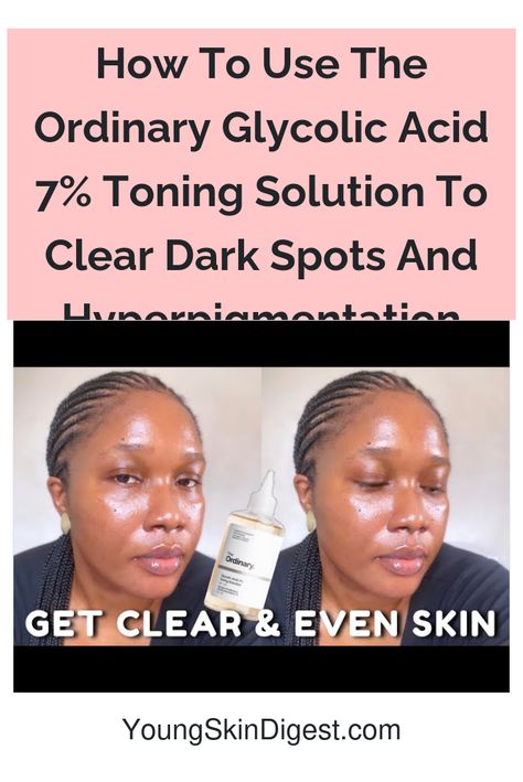 How To Use The Ordinary Glycolic Acid 7% Toning Solution To Clear Dark Spots And Hyperpigmentation Diy Skin Care Recipes Dark Spots, Remove Dark Spots Inner Thigh, Glycolic Acid Before And After, Clear Dark Spots, The Ordinary Glycolic Acid, Dark Spots On Face, Reduce Hyperpigmentation, Diy Skin Care Recipes, Spots On Face