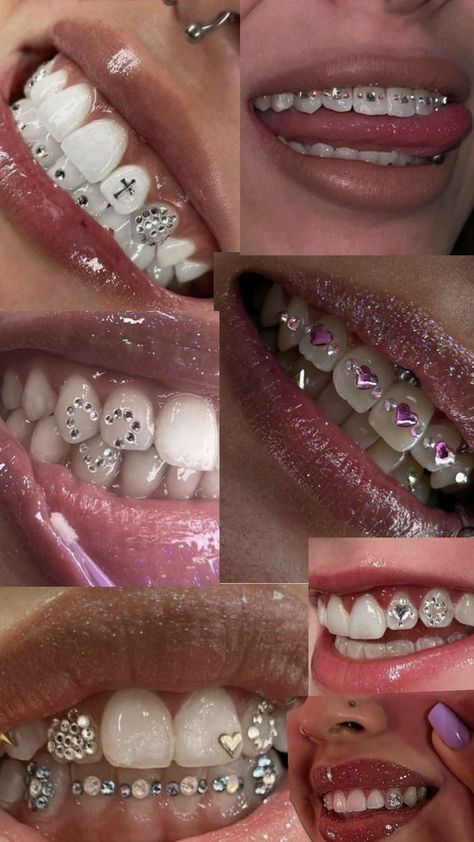 Silver Teeth Aesthetic, Tooth Gems Braces, Teeth Gem Designs, Tooth Gems Design, Strass Teeth, Girly Grillz, Teeth Jewels, Teeth Gems Diy, Human Teeth Jewelry