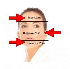 The Breakout Zones Face Breaking Out, Danger Danger, Skin Facts, Acne Makeup, Beauty Rules, Face Oils, Deep Breaths, Foot Spa, Cystic Acne