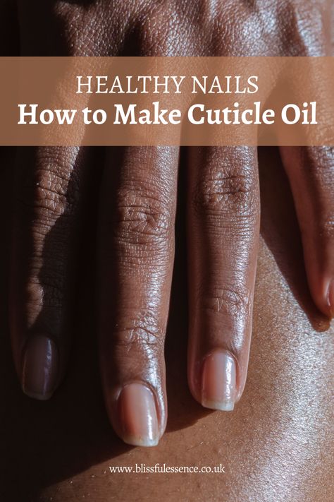 Homemade Cuticle Oil, Nail Remedies, Natural Nail Care, Nail Infection, Diy Beauty Treatments, Cuticle Care, Nail Care Tips, Nail Care Routine, Brittle Nails