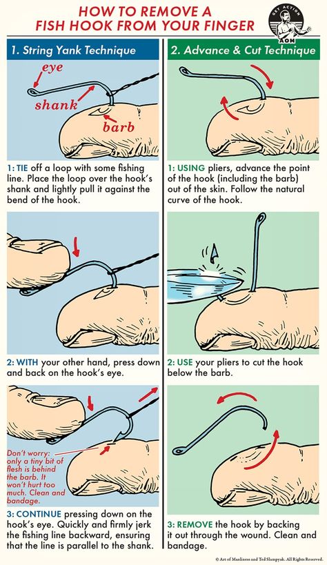 How to Remove a Fish Hook | The Art of Manliness Survival Skills Life Hacks, Art Of Manliness, Survival Life Hacks, Survival Techniques, Survival Life, Wilderness Survival, Smart Solutions, Medical Illustration, Camping Survival