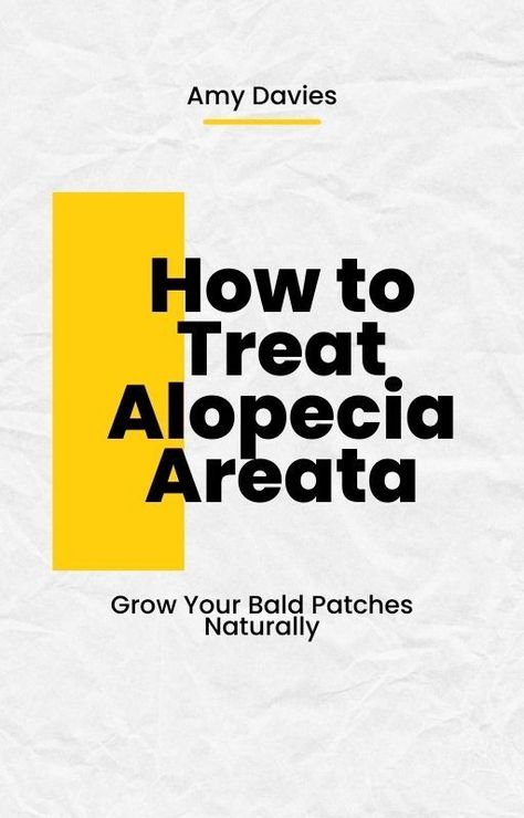 Looking for natural remedies for treating alopecia areata? Check out this ebook titled, "How to Treat Alopecia Areata: Grow Your Bald Patches Naturally" by Amy Davies. Grow Hair Overnight, Growing Long Hair Faster, How To Grow Hair, Grow Thicker Hair, Healthy Life Hacks, Bald Patches, Hair Growth Cycle, Bald Spot, Regrow Hair