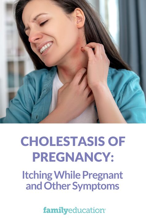 Is itching during pregnancy normal? Intrahepatic cholestasis of pregnancy (or ICP) is a condition that affects the liver function of expectant mothers. And if you’re wondering what this has to do with severe itching, we’ve got the scoop on ICP. #pregnancytips Itching During Pregnancy, False Labor, Braxton Hicks, Pregnancy Calculator, Liver Function, Health Podcast, Toddler Discipline, Pregnancy Signs, Birth Plan