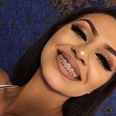 Colours For Brown Hair, Braces Colors Black, Braces Makeup, Braces Colours, Braces Smile, Cute Braces Colors, Gray Headboard, Braces Tips