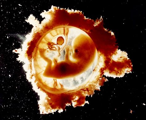 Photo by Lennart Nilsson: Eleven-week-old human fetus, 1965. Womb Art, Ib Art, Medical Videos, Oldest Human, Fetal Development, Baby Stage, Unbelievable Facts, A Child Is Born, Medical Illustration