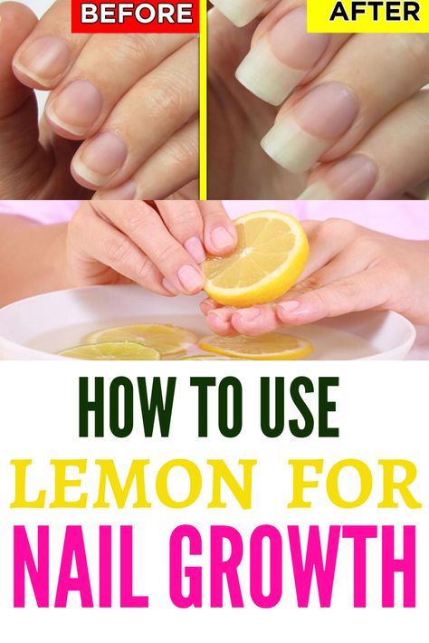 Nail Growth Faster, Grow Long Nails, Nail Growth Tips, Grow Nails Faster, Fast Nail, Milky Nails, Nail Care Tips, Nail Care Routine, How To Grow Nails