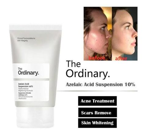 The Ordinary Azelaic Acid, Haut Routine, Clear Healthy Skin, Natural Face Skin Care, Serious Skin Care, Skin Care Tutorial, Basic Skin Care Routine, Clear Skin Tips, Azelaic Acid