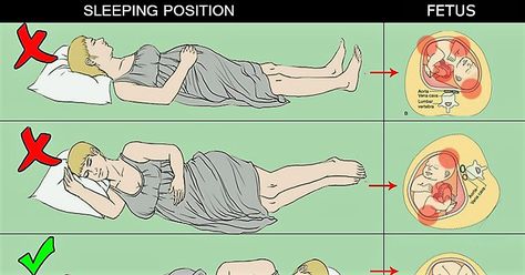 Want to know sleeping positions during pregnancy? Can you lay on your stomach while pregnant? Read here to know more on sleeping on stomach during pregnancy Pregnancy Cartoon, Sleeping When Pregnant, Pregnancy Sleeping Positions, Sleep While Pregnant, Pregnancy Care Package, 27 Weeks Pregnant, Pregnant Sleep, Pregnancy Calculator, Happy Pregnancy