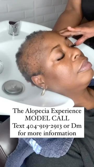 Alopecia Hairstyles Black Women, Bald Spots Women, Alopecia Awareness, Alopecia Hairstyles, Short Weave, Bald Spot, Model Call, Becoming A Model, Hair Stuff