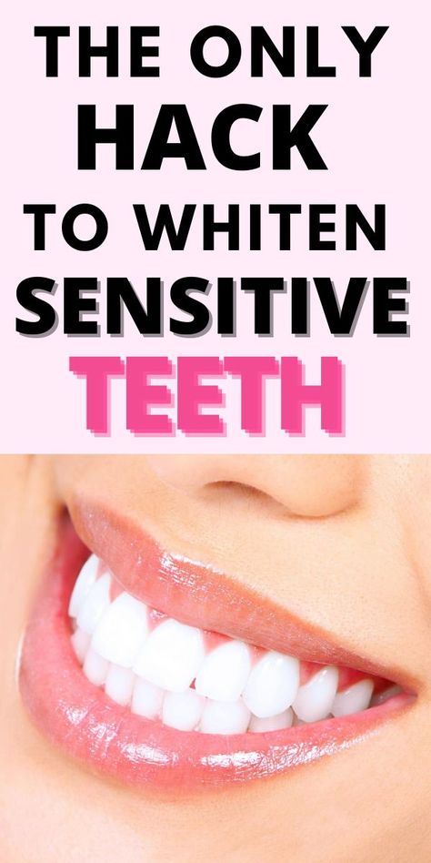 Sensitive teeth can be whitened, but it is important to approach the process with caution and choose the right whitening method. Thankfully, there are several teeth whitening remedies available for individuals with sensitive teeth.. Toothache Relief, Teeth Whitening Remedies, Teeth Whitening Diy, Teeth Bleaching, Whiten Teeth, Tooth Sensitivity, Oral Care Routine, Gum Care, Receding Gums