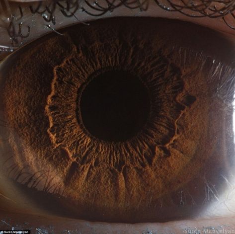 The iris is divided into two major regions: The pupillary zone is the inner region whose edge forms the boundary of the pupil. The ciliary zone is the rest of the iris that extends to its origin at the ciliary body Macro Photography Eyes, Eye Pupil, Iris Eye, Eye Close Up, Human Eyes, Human Body Parts, Eye Photography, Human Eye, Body Glitter