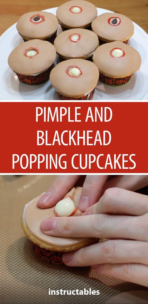 For those with the fixation of popping pimples, make up a batch of these pimple and blackhead popping cupcakes for your friends this Halloween. #halloween #dessert #cupcakes #party #gross Pimple Cupcakes, Halloween Dessert Cupcakes, Halloween Potluck Ideas For Work, Pimple Poppìng, Natural Remedies For Congestion, Popping Pimples, Natural Remedies For Sunburn, Halloween Potluck, Halloween Dishes