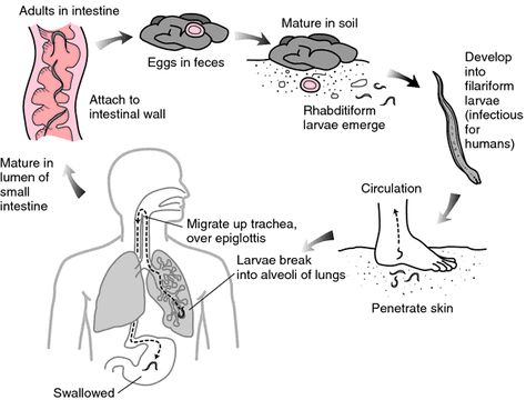 Ancylostomiasis | definition of ancylostomiasis by Medical dictionary Medical Dictionary, Health Topics, Small Study, Medical Terms, Autoimmune Disorder, Improve Health, Blood Vessels, Life Cycles, Disease