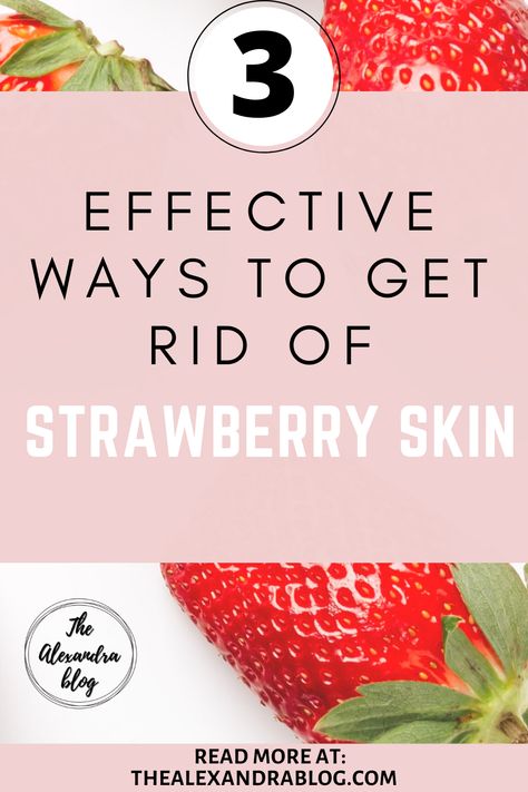 Strawberry Legs Remedy At Home, Strawberry Bumps On Skin, How To Get Rid Of Strawberry Legs Fast Naturally, How To Get Rid Of Strawberry Legs Fast At Home, How To Get Rid Of Strawberry Skin, Strawberry Skin How To Get Rid, Strawberry Legs Remedy How To Get Rid, Strawberry Legs Remedy Diy, Strawberry Arms