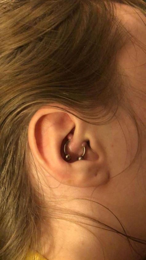 Piercing Room, What Causes Pimples, Pimple Causes, Piercing Accessories, Piercing Bump, Double Ear Piercings, Piercing Cartilage, Natural Cold Remedies, Pop Pop