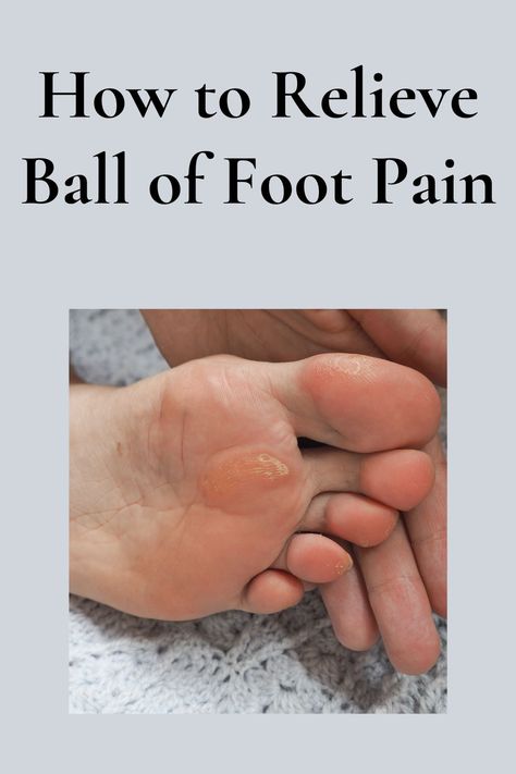 Ball of foot pain can be a frustrating and debilitating issue that affects many people. It can cause discomfort and pain when walking, running, or standing for long periods of time. Fortunately, there are several ways to relieve ball of foot pain and get back to your daily activities. Hip Out Of Alignment, Sore Feet Relief, Foot Pain Chart, Sore Feet Remedies, Foot Pain Relief Remedies, Nerve Pain Remedies, Pain Relief Remedies, Foot Exercises, Healing Remedies