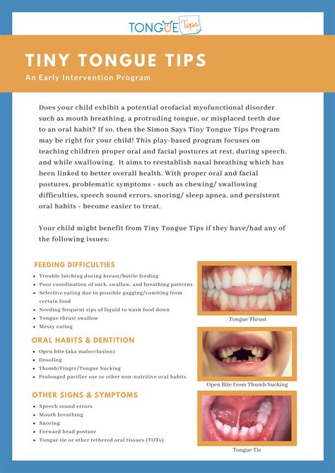 Tiny-Tongue-Tips-Pamphlet-(1) Orofacial Myofunctional Therapy, Tongue Thrust, Myofunctional Therapy, Muscles Of The Face, Feeding Therapy, Speech Articulation, Speak Easy, Oral Motor, Articulation Therapy