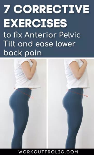 Hip Alignment Exercises, Corrective Exercises, Lower Back Pain Stretches, Posture Correction Exercises, Postpartum Workouts, Fix Your Posture, Mom Body, Physical Inactivity, Pelvic Tilt