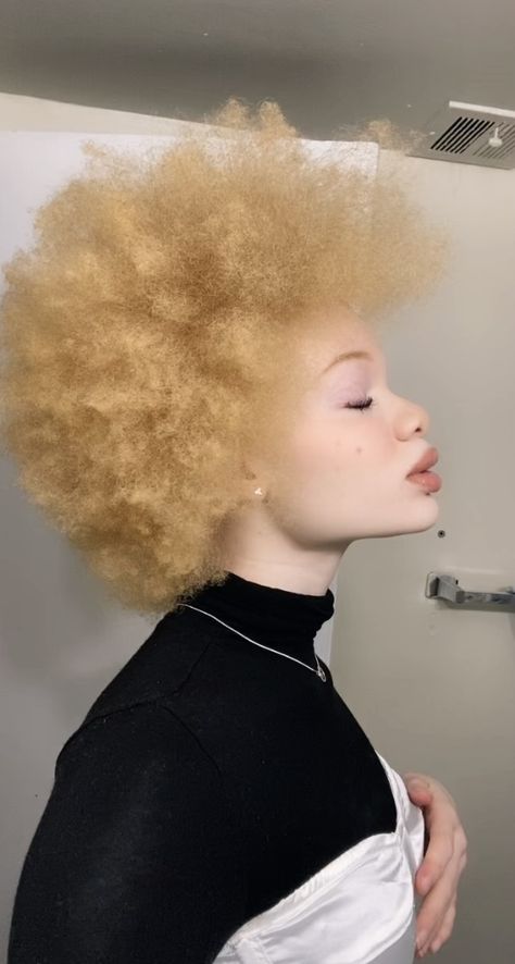 Albino Girl, Hype Hair, Goddess Braids Hairstyles, Drawing People Faces, Black Person, Wig Making, Goddess Braids, Afro Hairstyles, Black People