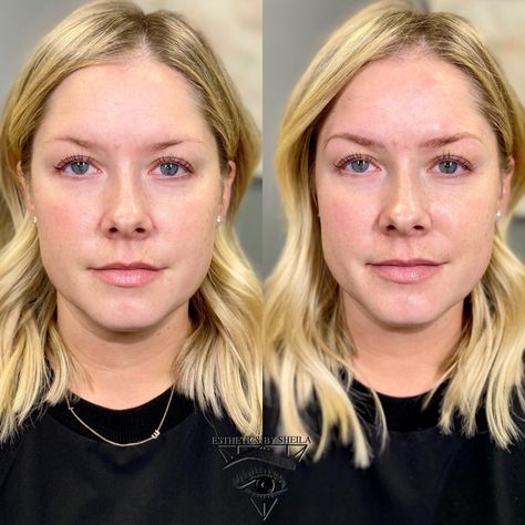 I Got My Eyebrows Microbladed (part 1) – The Small Things Blog Eyebrow Before And After, The Small Things Blog, Blonde Eyebrows, Small Things Blog, Numbing Cream, Natural Eyebrows, The Small Things, Microblading Eyebrows, How Many People