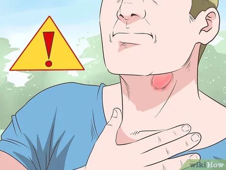 How to Get Rid of a Sore Throat Quickly (with Pictures) - wikiHow Mucus In Throat, Getting Rid Of Mucus, Mucus Relief, Getting Rid Of Phlegm, Throat Remedies, Sore Throat Remedies, Throat Pain, Throat Infection, Throat Spray