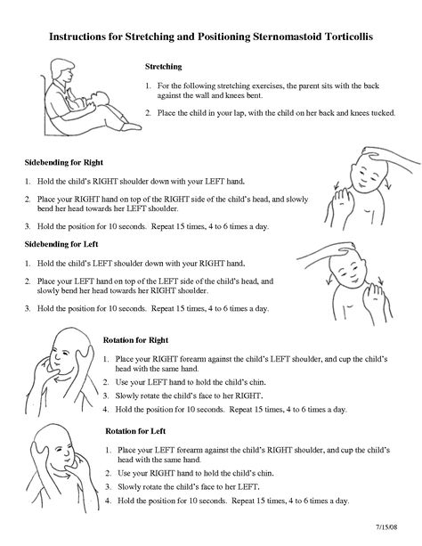 Exercises for Torticollis Therapeutic Exercise Occupational Therapy, Occupational Therapy Pediatric Documentation, Pediatrics Physical Therapy, Pediatric Physical Therapy Exercises, What Is Pediatric Occupational Therapy, Flat Head Syndrome, Craniosacral Therapy, Occupational Therapy Kids, Pediatric Physical Therapy