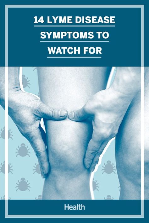 Symptoms of Lyme disease in humans can be vague, and chances are you have no idea you’ve been bitten by an infected tick until symptoms surface. Knowing the symptoms to look for can help diagnose Lyme disease early on, when it's easily treatable. #lymedisease #health Autoimmune Disease Symptoms, Swollen Knee, Medical Laboratory Science, Disease Symptoms, Nerve Pain, You Have No Idea, Autoimmune Disease, Knee Pain, Holistic Healing