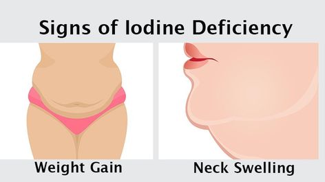 Iodine Supplement Benefits, Iodine Foods, Iodine Deficiency Symptoms, Iodine Benefits, Foods With Iodine, Healthy Tricks, Enlarged Thyroid, I Choose Happy, Iodine Supplement