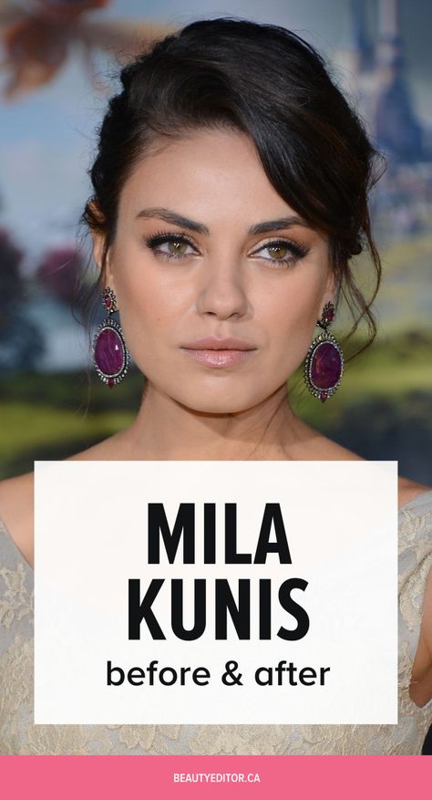 Mila Kunis Eyebrows, Mila Kunis Diet, Eye Brow Lift Before And After, Mila Kunis Hairstyles, Pueraria Mirifica Before And After, Eye Lift Before And After, Before And After Plastic Surgeries, Eyebrow Lift Before And After, Mika Kunis Hair