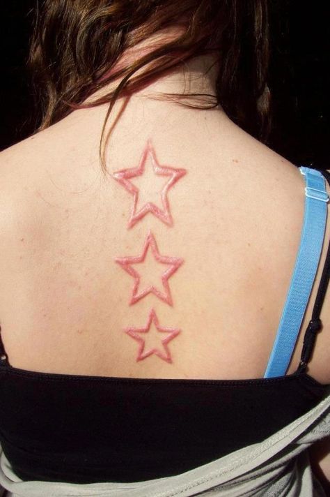 Losing 40 Pounds Changed My Life Tattoo Over Self Scar, Scarification Tattoo Healed, Scarification Tattoos, Scars Tattoo, Tattoo Over Scar, Scar Tattoo, Skin Natural Remedies, Healing Tattoo, Cold Sores Remedies