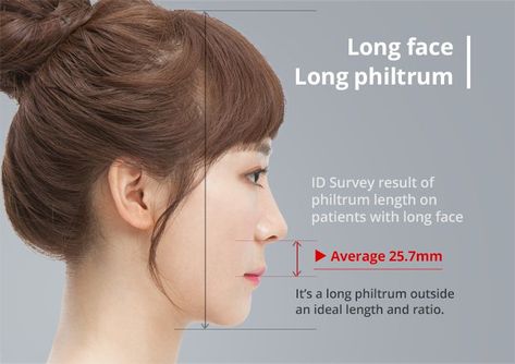 length-of-philtrum-and-ratio Long Philtrum, Reduction Surgery, Facial Contouring, Facial Aesthetics, Before After Photo, Long Faces, Anatomy Reference, After Photos, Free Consultation