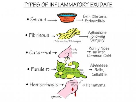 Nursing Study: Types of Inflammatory Exudate Nursing Concepts, Wound Care Nursing, Nursing Pictures, Nursing Study Tips, Nursing Information, Nursing Mnemonics, Surgical Nursing, Nursing School Survival, Fundamentals Of Nursing