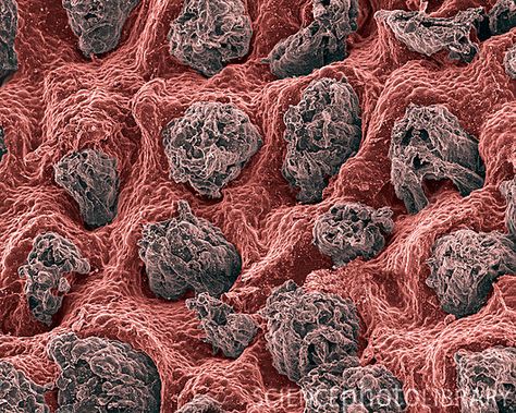 Human tongue surface, coloured scanning electron micrograph (SEM). Covering the tongue's surface are scale-like projections called filiform papillae, which sense pressure. The round areas (purple) are fungiform papillae which contain the taste buds. Human Tongue, Electron Microscope Images, Scanning Electron Microscope, Scanning Electron Micrograph, Microscopic Photography, Micro Photography, Photo Macro, Microscopic Images, Electron Microscope