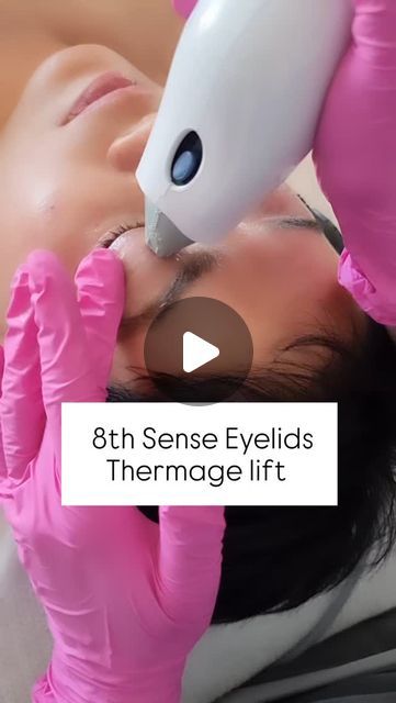 8th Sense Aesthetic Religion on Instagram: "Concerned about sagging eyelids but not ready for surgery? Thermage eye lift is a non-surgical solution for sagging and crepey skin on the upper and the bottom eyelids. THERMAGE EYES' has FDA approval and peer-reviewed studies about its efficacy. It is done in a single procedure and without any downtime. We usually combine with polynucletides for enhanced effect. This is the latest  approach of REGENERATIVE Aesthetics!   Book 8th Sense Thermage  0118846418 0847048888 . . . #Thermage #saggingeyelids #nonsurgicaleyelift  #Nonsurigal  #crepeyskin  #skincareregime  #skindoctor #skin #saggingskin #antiagingproduct  #antiagingtool  #antiaging  #drslynedic  #8thsenseantiaging  #aestheticdoctor  #aestheticprocedures  #aesthetic  #threading  #botoxfillers 8 Sense, Sagging Eyelids, Aesthetic Doctor, Eyelid Lift, Upper Eyelid, Botox Fillers, Crepey Skin, Eye Lift, Sagging Skin