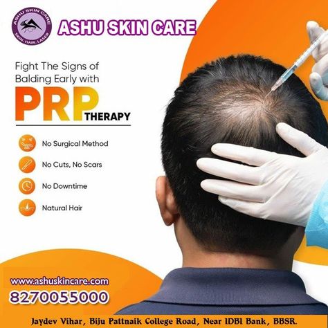 Prp For Hair Growth, Hair Prp Before And After, Hair Transplant Creative Ads, Prp For Hair, Prp Therapy, Hair Implants, Dental Posts, Prp Hair, Skin And Hair Clinic