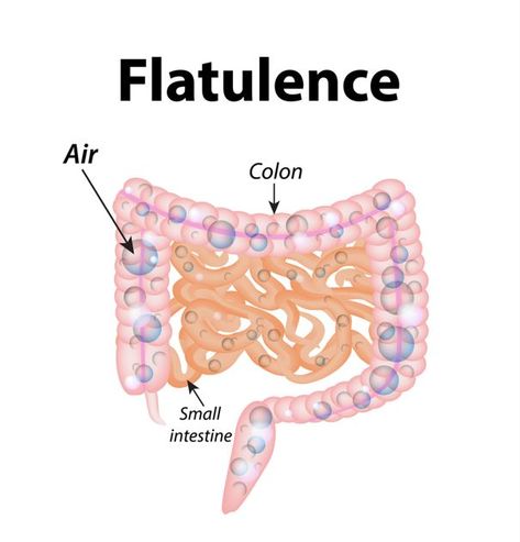 Foods to Avoid on the Low-Flatulence Diet - Facty Health Non Gassy Foods, Gassy Foods, Small Intestine, Colon Health, Starchy Foods, Fava Beans, Large Intestine, Average Person, Healthier Me