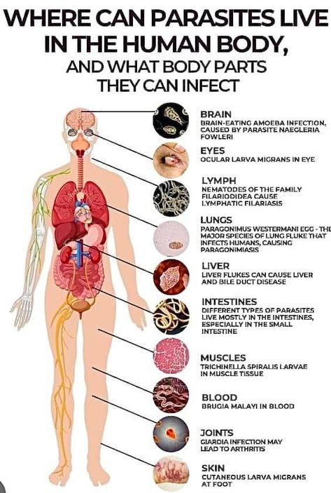 Zahrah Sita Herbal Parasite Cleanse, Parasites Symptoms, Liver Fluke, Intestinal Parasites, Parasite Cleanse, Bile Duct, Stronger Immune System, Stomach Acid, Muscle Tissue