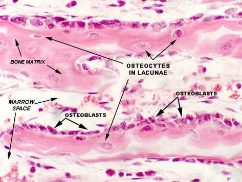 ossification of spongy bone histology - Google Search Bone Histology, Cancellous Bone, Histology Slides, Exam Review, Human Hands, Anatomy, Bones, Science, Google Search