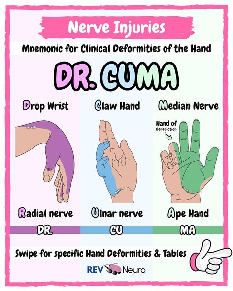 Did you recognize the doctor in the operating room today? 👀 Btw this is our longest lesson to date! 👋🏼 Which character should we do next? 🤔 Comment your choice below and we’ll illustrate and diagnose them! 👀 If you’re enjoying this lesson and learning a little something… consider following these pages ⤵️ 👉🏼 @rev.med 👉🏼 @rev.neuro 🎵 We have a special song dedicated to this lesson that will be released soon! It’s all about Dr. Kenzo Tenma the neurosurgeon in the anime ‘Monster’ Clinical D... Medical Worksheets, Dr Kenzo Tenma, Nurse Hacks, Med Surge, Study Tricks, Nursing Knowledge, Pt School, Nursing 101, Medical Mnemonics