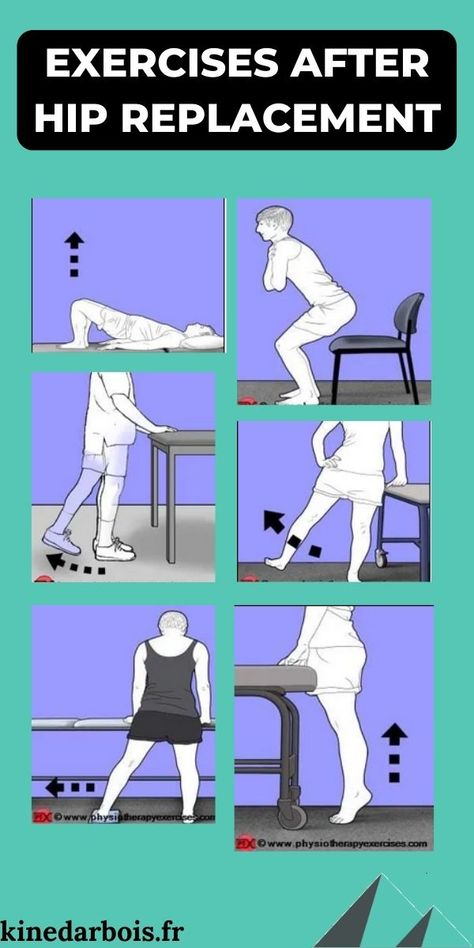 Physical Therapy After Hip Replacement Surgery: Guide & Tips! Hip Surgery Recovery, Best Exercise For Hips, Hip Strengthening Exercises, Human Spine, 12 Minute Workout, Hip Surgery, Physical Therapy Exercises, Surgery Recovery, Knee Replacement