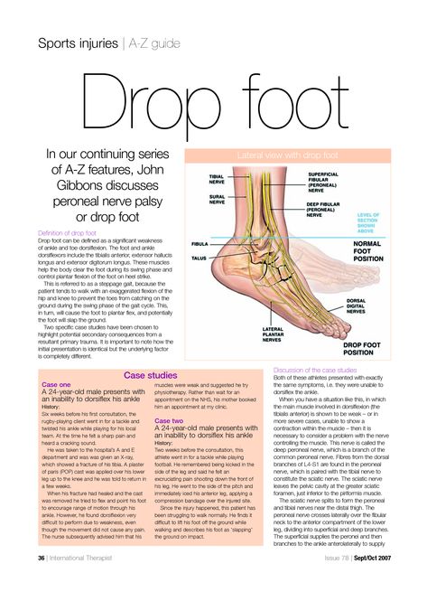 Drop Foot Exercises, Big Toe Pain, Foot Drop Exercises, Crunchy Stuff, Ms Exercises, Cauda Equina, Foot Exercises, Craniosacral Therapy, Muscle Atrophy