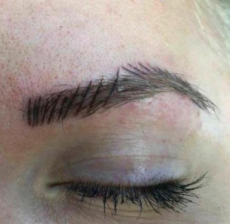 Viral photos highlight the risks of going to a REALLY bad eyebrow salon Bad Eyebrow Tattoo, Eyebrow Fails, Eyebrow Before And After, Bad Eyebrows, Eyebrow Design, Eyebrow Hacks, Permanent Makeup Eyebrows, Lashes Beauty, Microblading Eyebrows