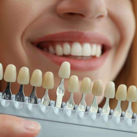 Our custom veneers are designed to enhance your unique features, giving you the confidence to smile wide. Ready to transform your smile? Schedule your consultation today!   Call us ☎️ 770-889-5335 #APlusDentistry #DrFarhang #CosmeticDentistry #Veneers Gum Surgery, Bone Grafting, Kedokteran Gigi, Porcelain Veneers, Dental Center, Pediatric Dentistry, Best Dentist, Perfect Smile, Healthy Smile