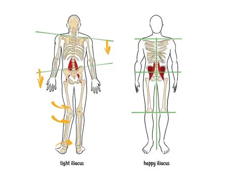 Deep Dive into the Anatomy of the Hip Flexor Muscles Hip Twists, Lumbar Lordosis, Hip Flexor Pain, Femur Bone, Pelvic Bone, Referred Pain, Muscle Knots, Hip Flexor Stretch, Tight Hip Flexors