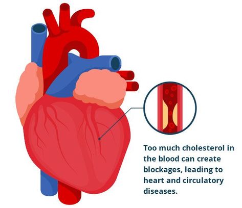 signs of high cholesterol on face,
what causes high cholesterol in women,
what can cause a sudden increase in cholesterol,
causes of high cholesterol in healthy person,
signs of high cholesterol in females,
my cholesterol is 7.1 is that high,
my cholesterol is 250 is that high,
what are the 5 signs of high cholesterol, Sport Drawing, Pencemaran Udara, Heart Blockage, Lower Cholesterol Naturally, To Lower Cholesterol, Health Heart, Clogged Arteries, Healthy Cholesterol Levels, Healthy Lifestyle Habits