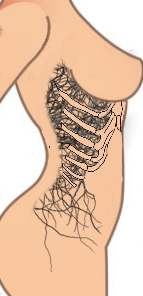 Female Rib Cage, Tattoo Ribcage, Rib Cage Tattoo, Cage Tattoo, Hospital Project, Haunted Hospital, Ribcage Tattoo, Tattoo Templates, Sides For Ribs